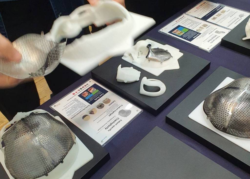 A Thai innovator committed to producing titanium plates for brain injury patients covered by UCS 